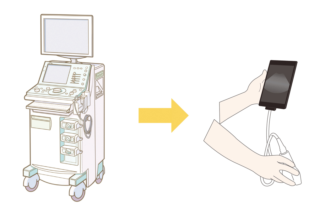 据え置き型エコー装置からポケットエコーへの写真