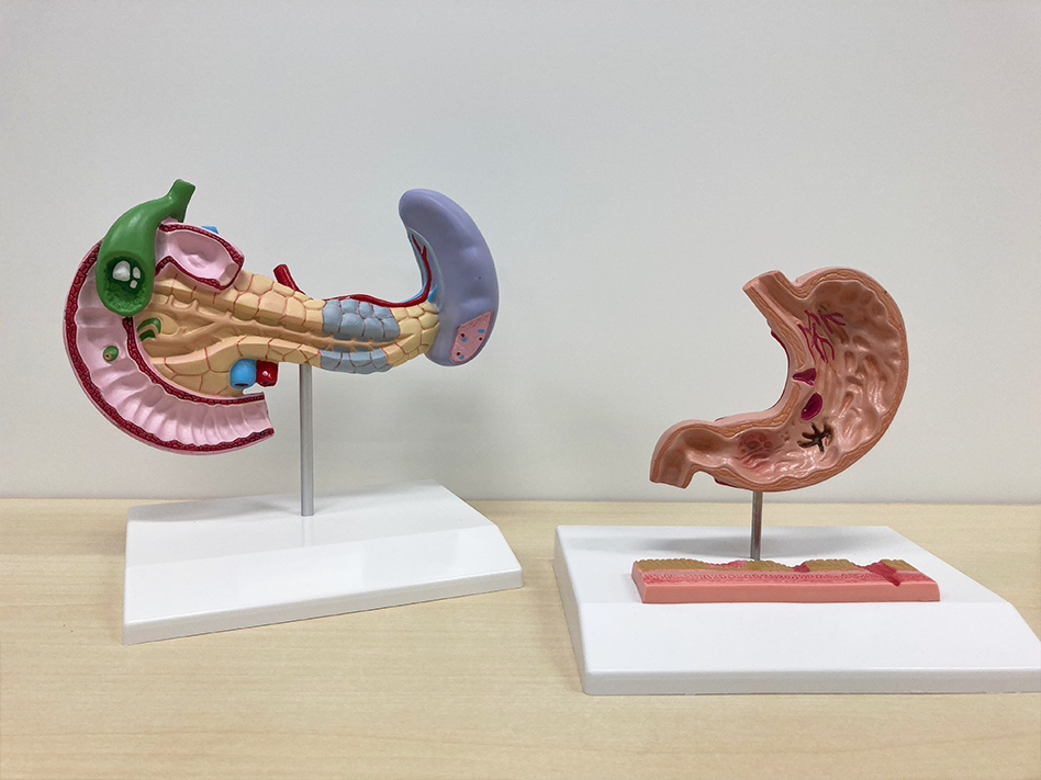 胃などの病理模型