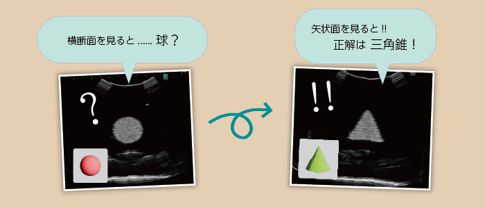 ブラックキューブの超音波画像