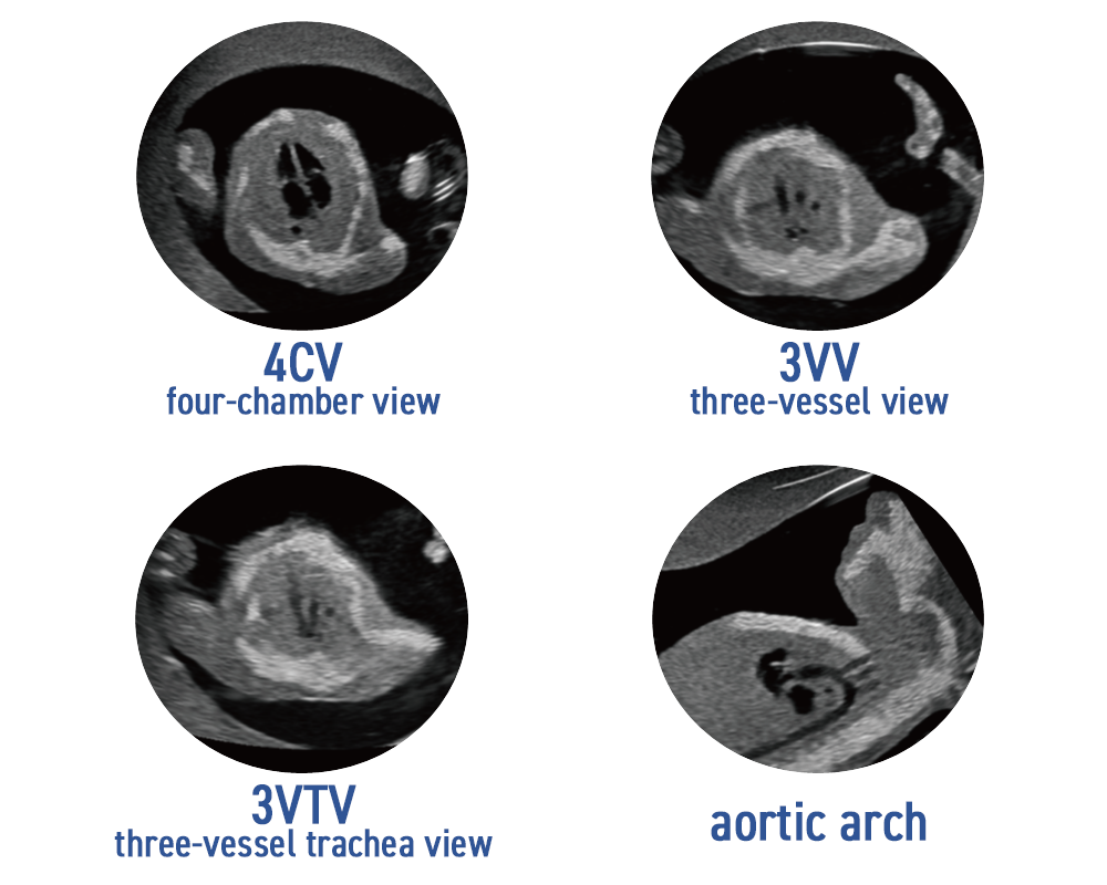 fetal echocardiography