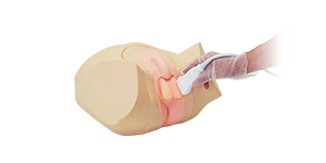 Scrotal Ultrasound Phantom