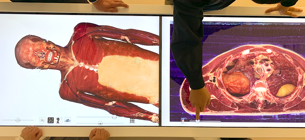 [画像：Anatomage Table 4]
