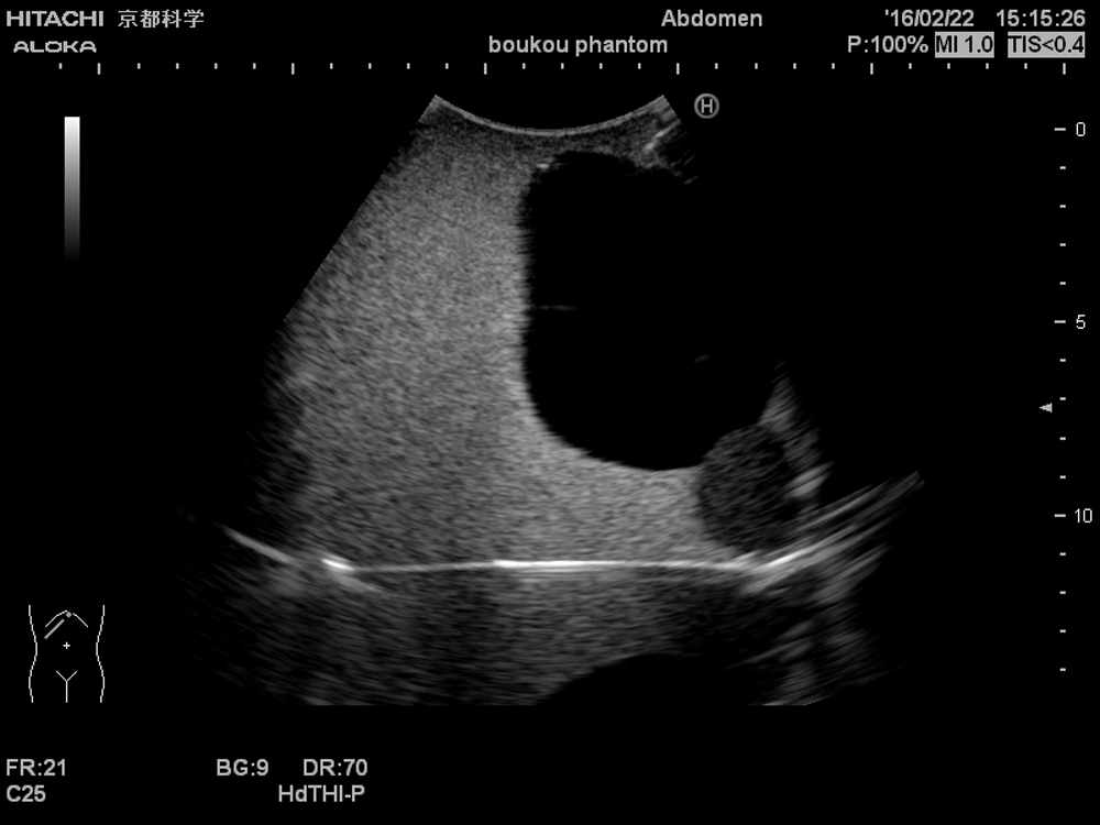 京都科学製ファントムの膀胱内の超音波画像