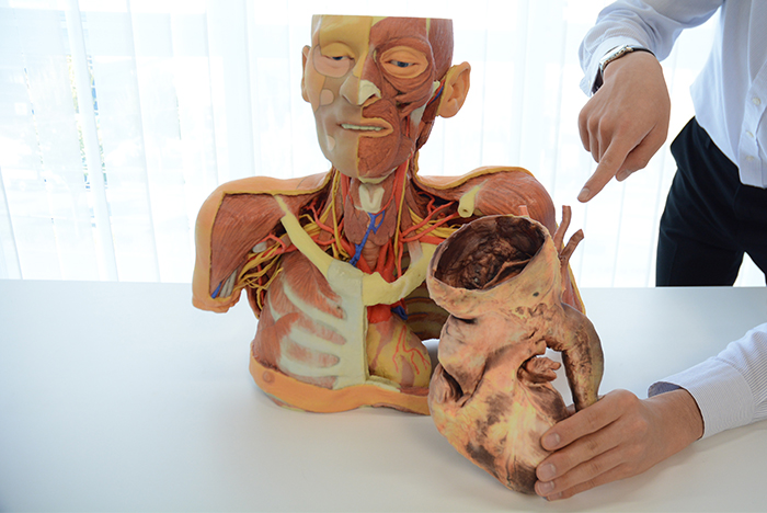 頭部から胸部の解剖と梅毒性大動脈瘤を見比べる写真