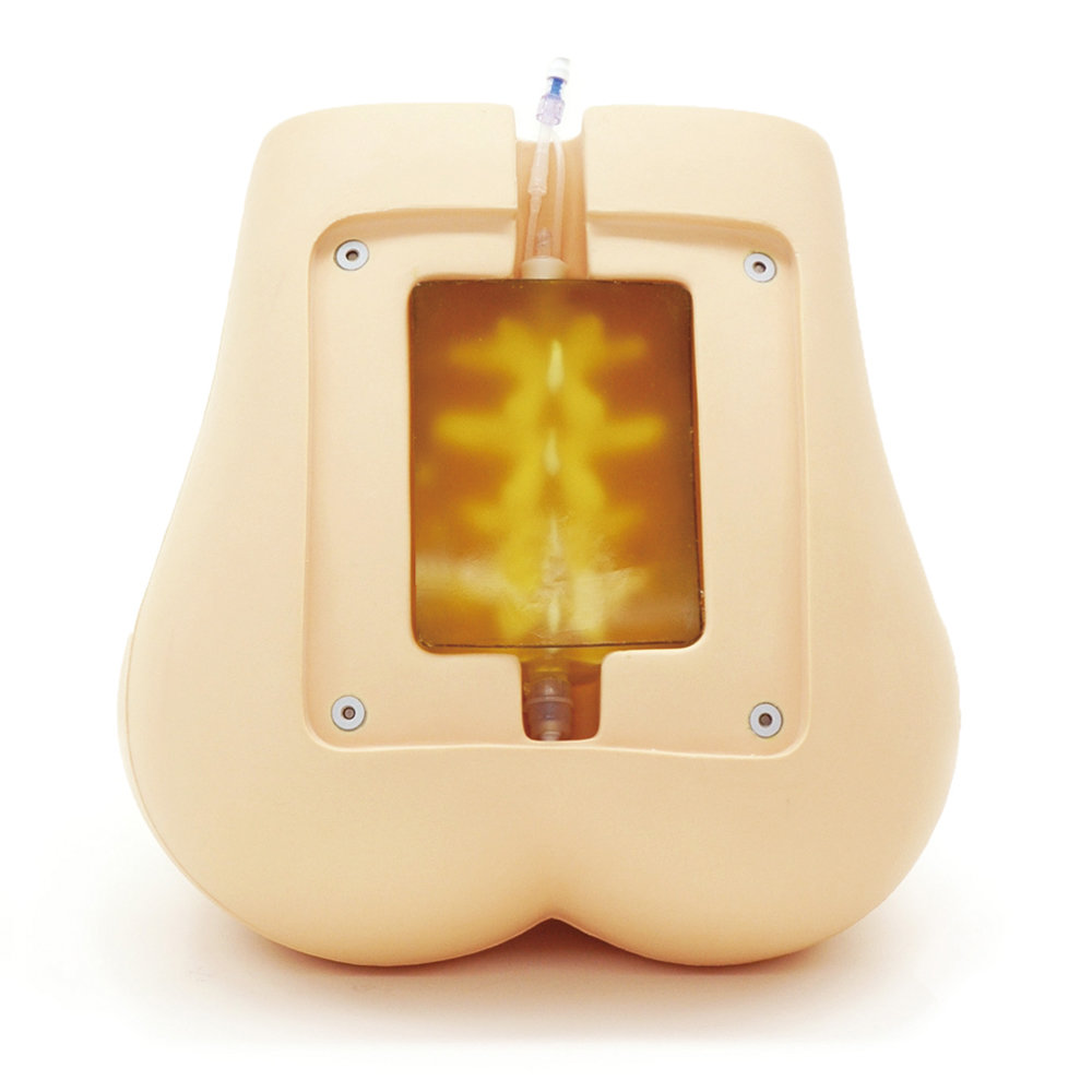 Ultrasound Compatible Lumbar Puncture/ Epidural  Simulator