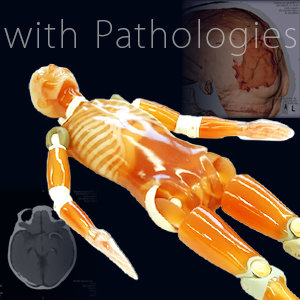 CT Whole Body Phantom with Pathologies