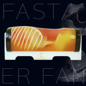 FAST/Acute Abdomen Phantom ”FAST/ER FAN”